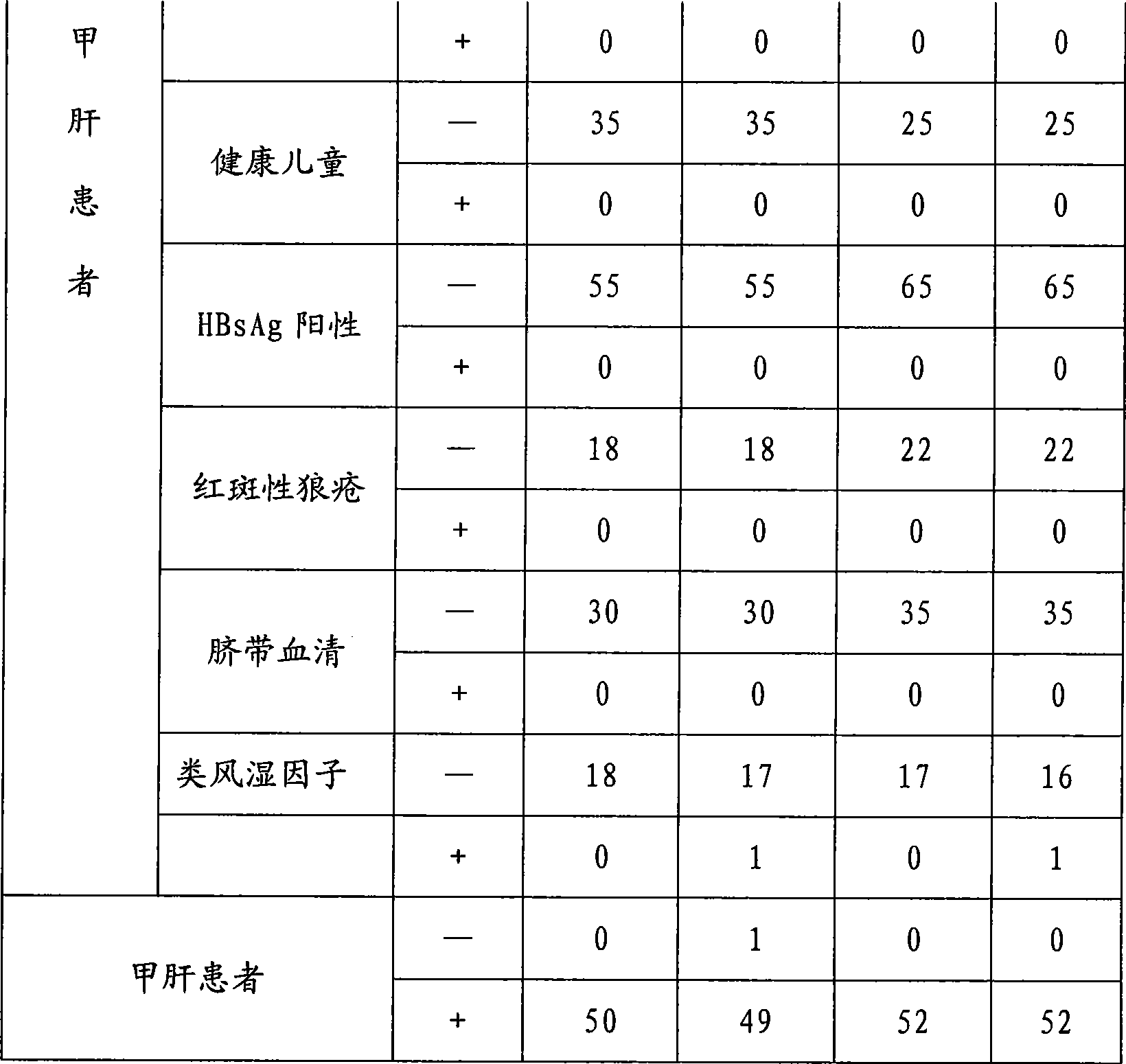 Chemoluminescent immunoassay kit of hepatitis A virus IgM antibody and preparation method thereof