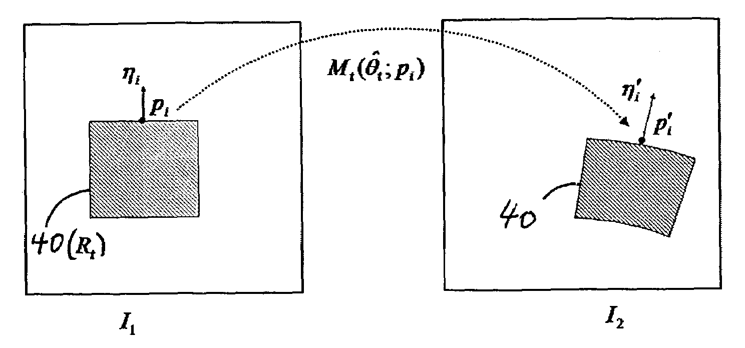 Dual bootstrap iterative closest point method and algorithm for image registration