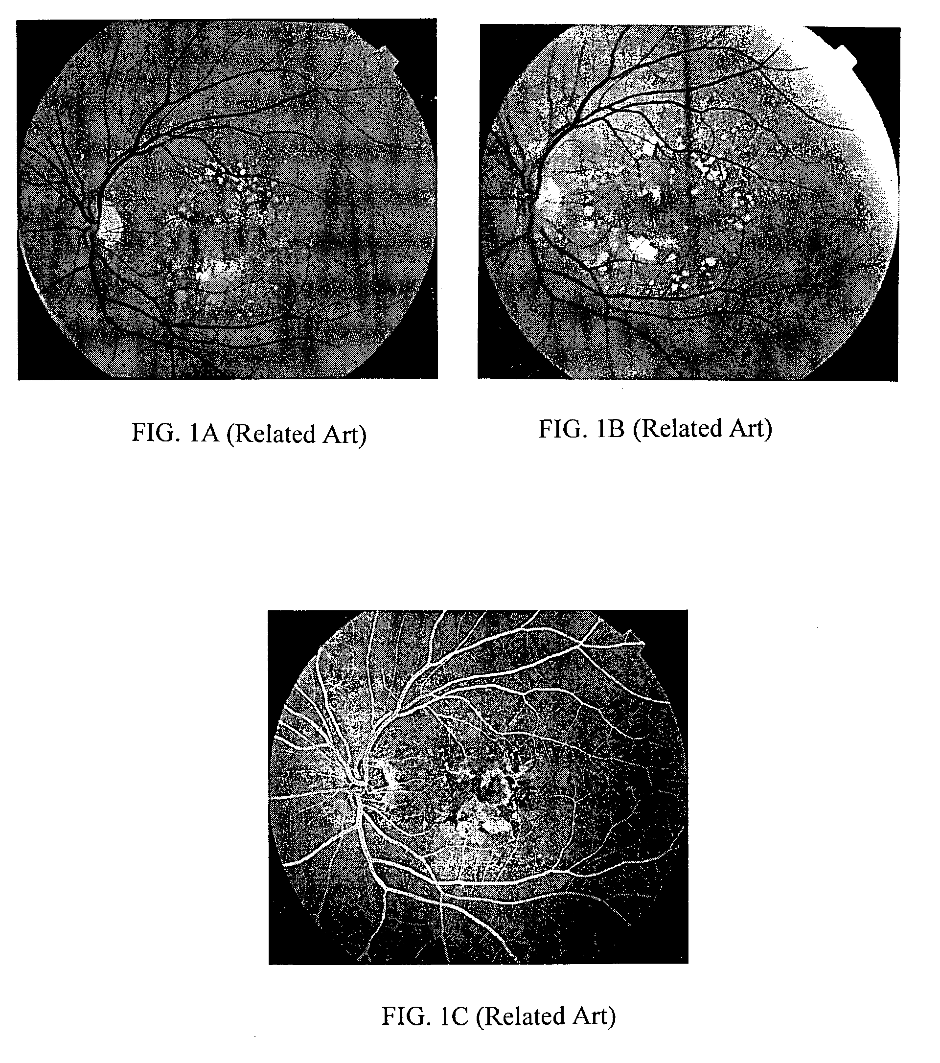 Dual bootstrap iterative closest point method and algorithm for image registration