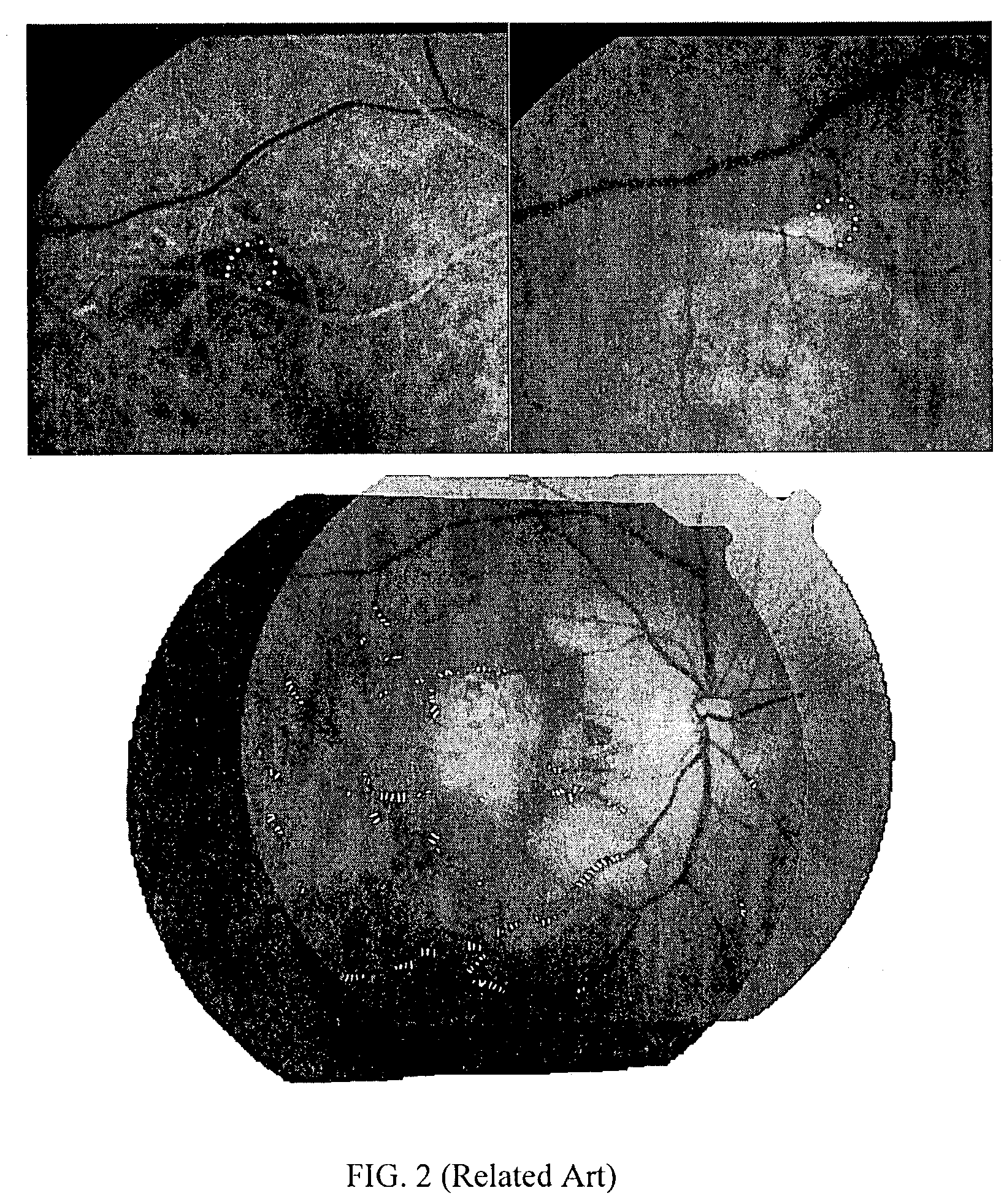 Dual bootstrap iterative closest point method and algorithm for image registration