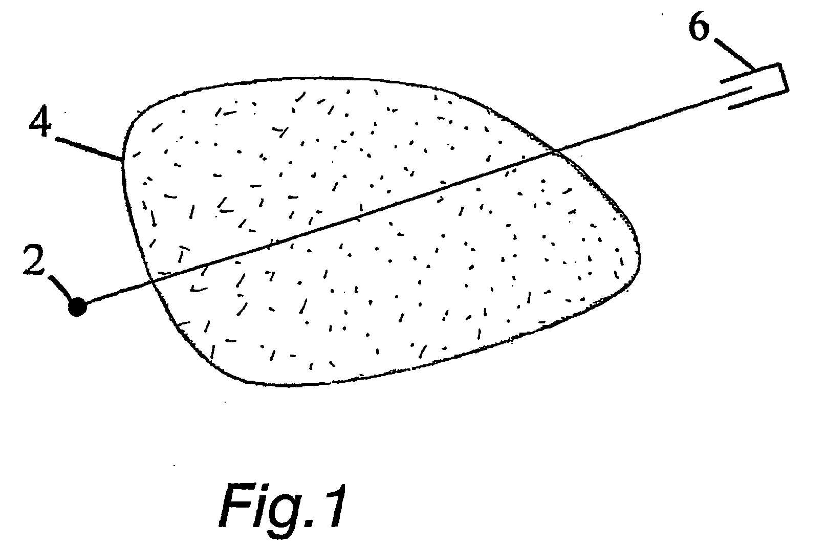 Method and arrangement for medical x-ray imaging and reconstruction from sparse data