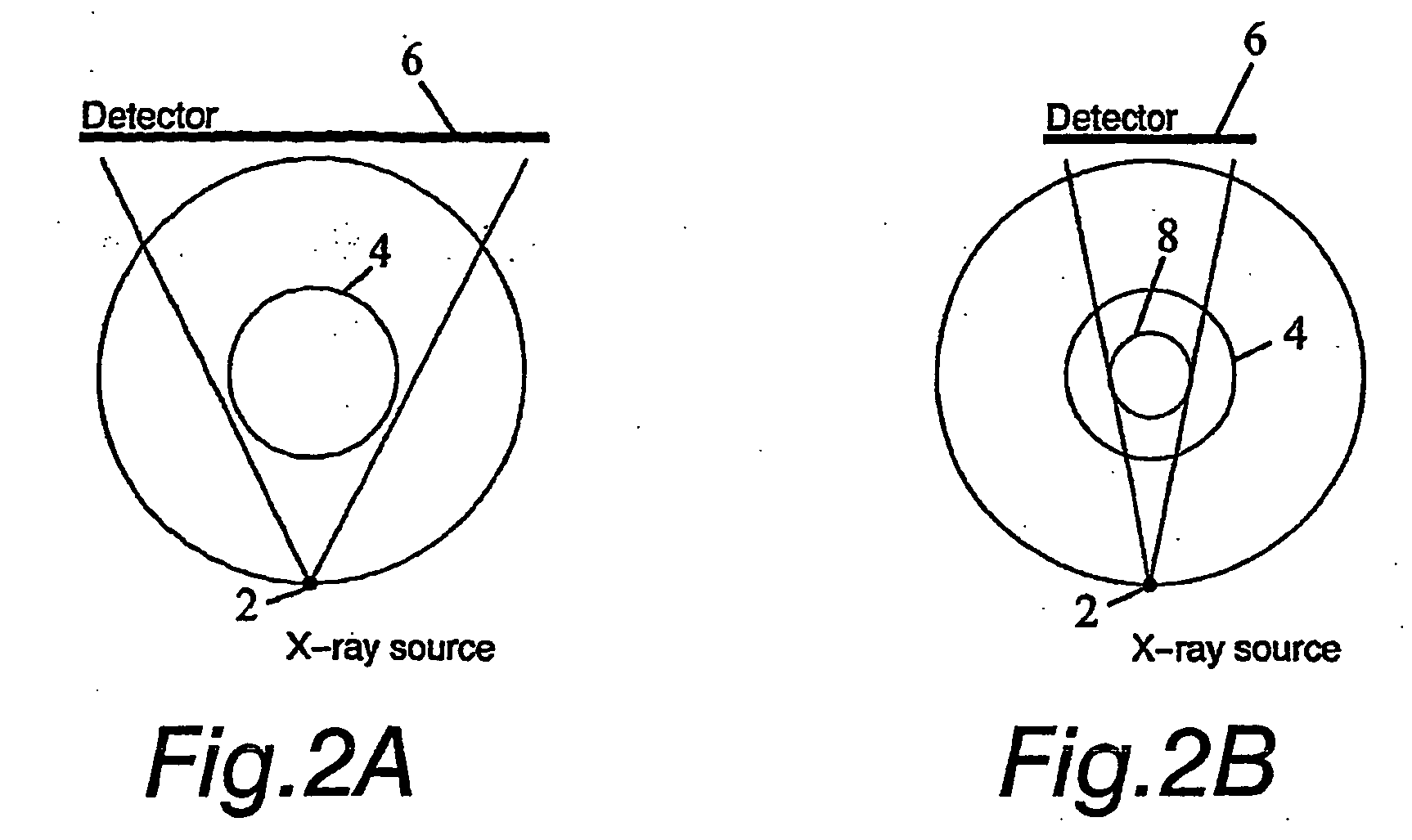 Method and arrangement for medical x-ray imaging and reconstruction from sparse data