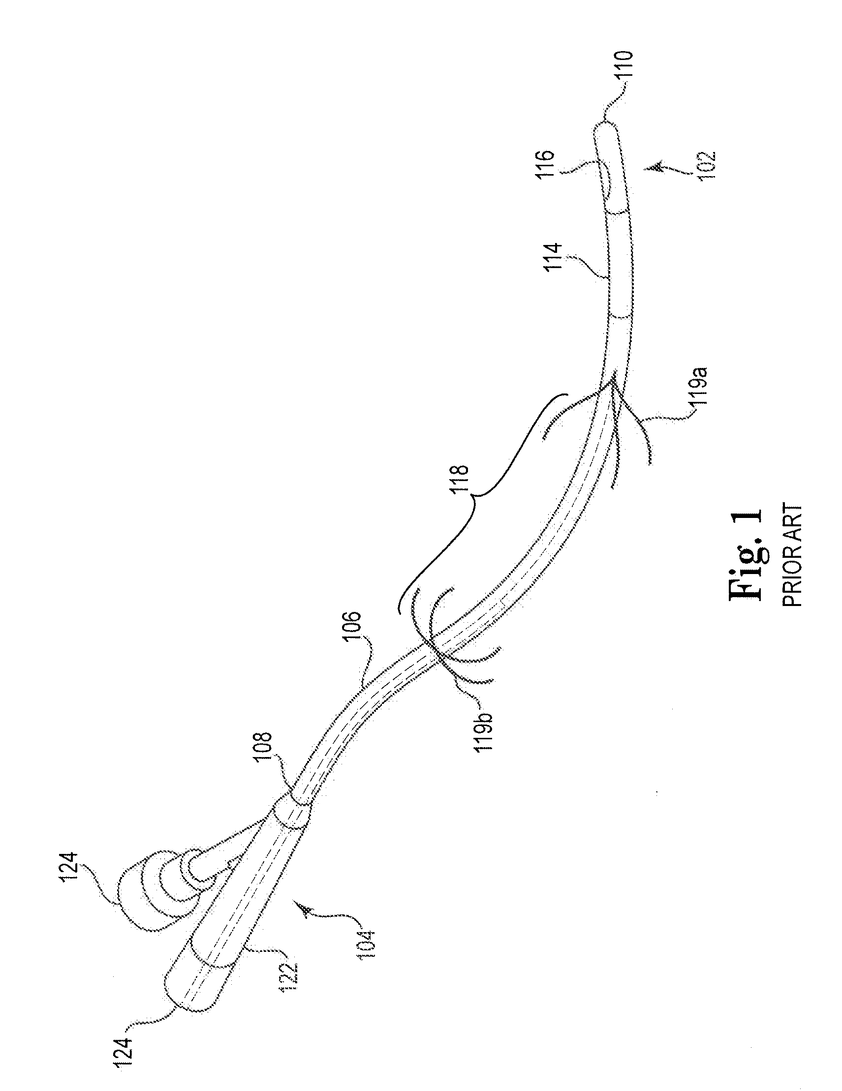 Anastomosis device and related methods