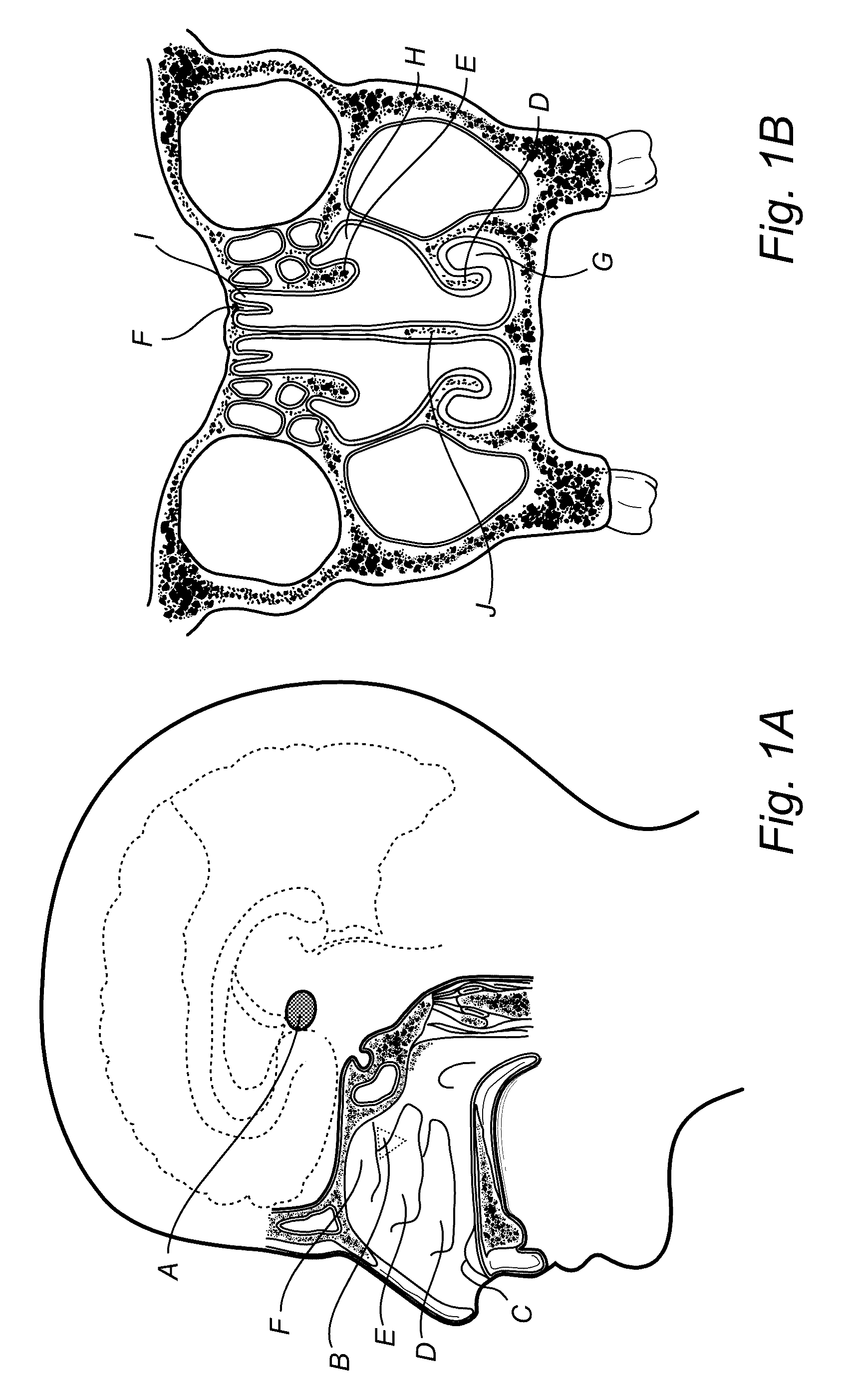 Treatment of headache disorders