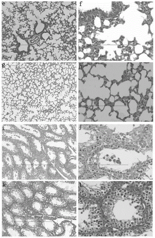 Novel application of Deinococcus radiodurans PprI protein and its pharmaceuticals