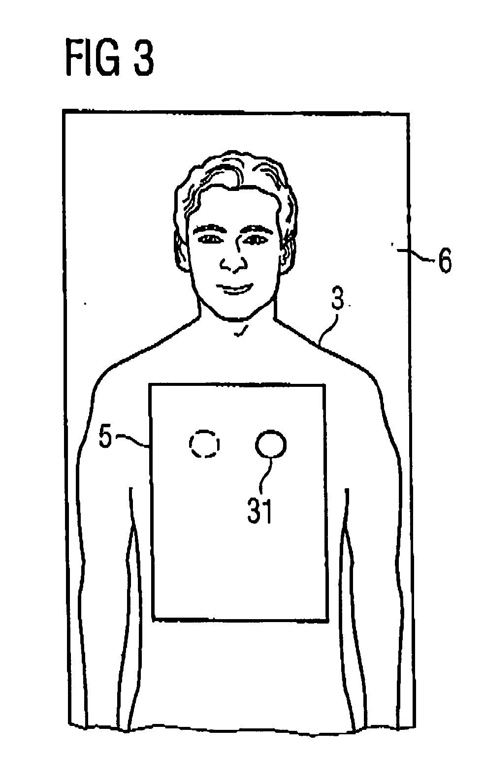 Local coil unit for a magnetic resonance apparatus