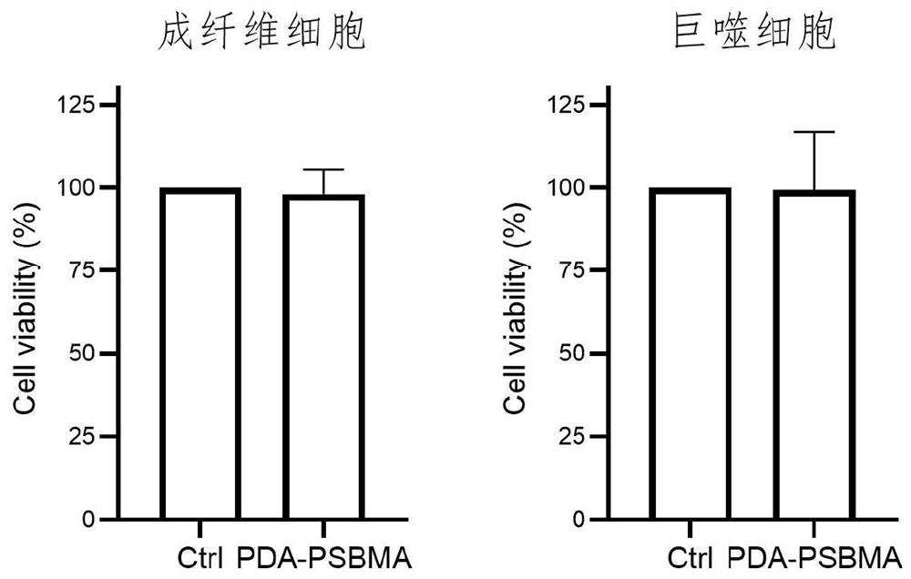 Polydopamine-zwitterionic polymer anti-adhesion coating modification method and application thereof