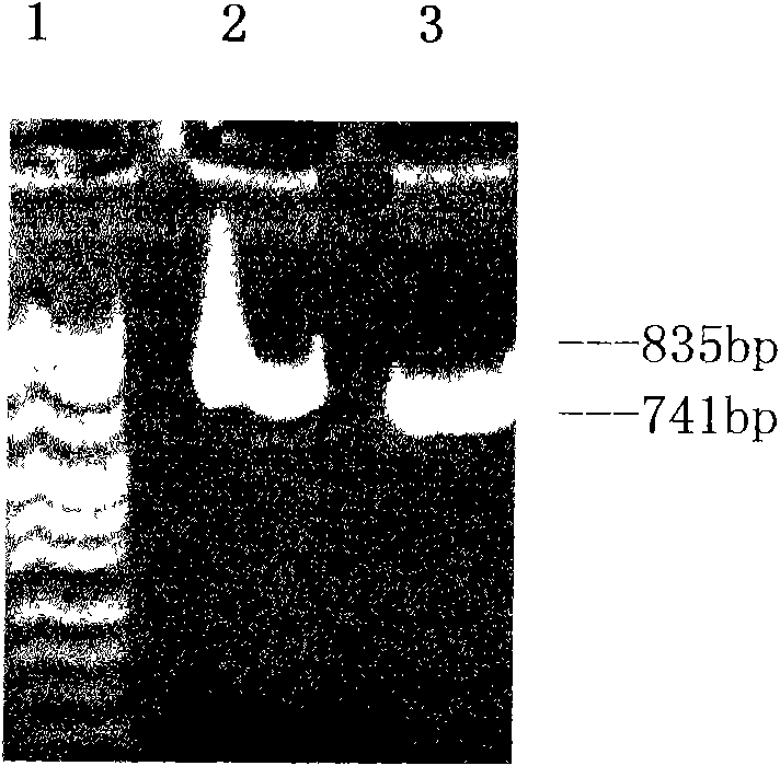 Application of recombinant FN heparin binding domain polypeptide on preparing medicament resisting invasion and metastasis of malignant tumor