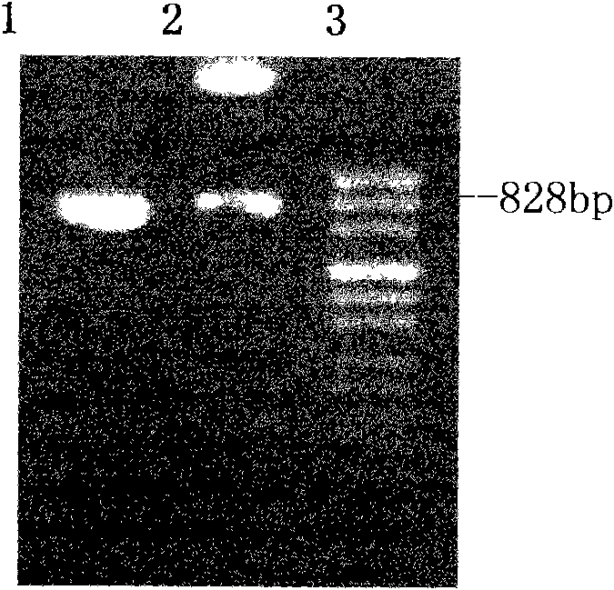 Application of recombinant FN heparin binding domain polypeptide on preparing medicament resisting invasion and metastasis of malignant tumor