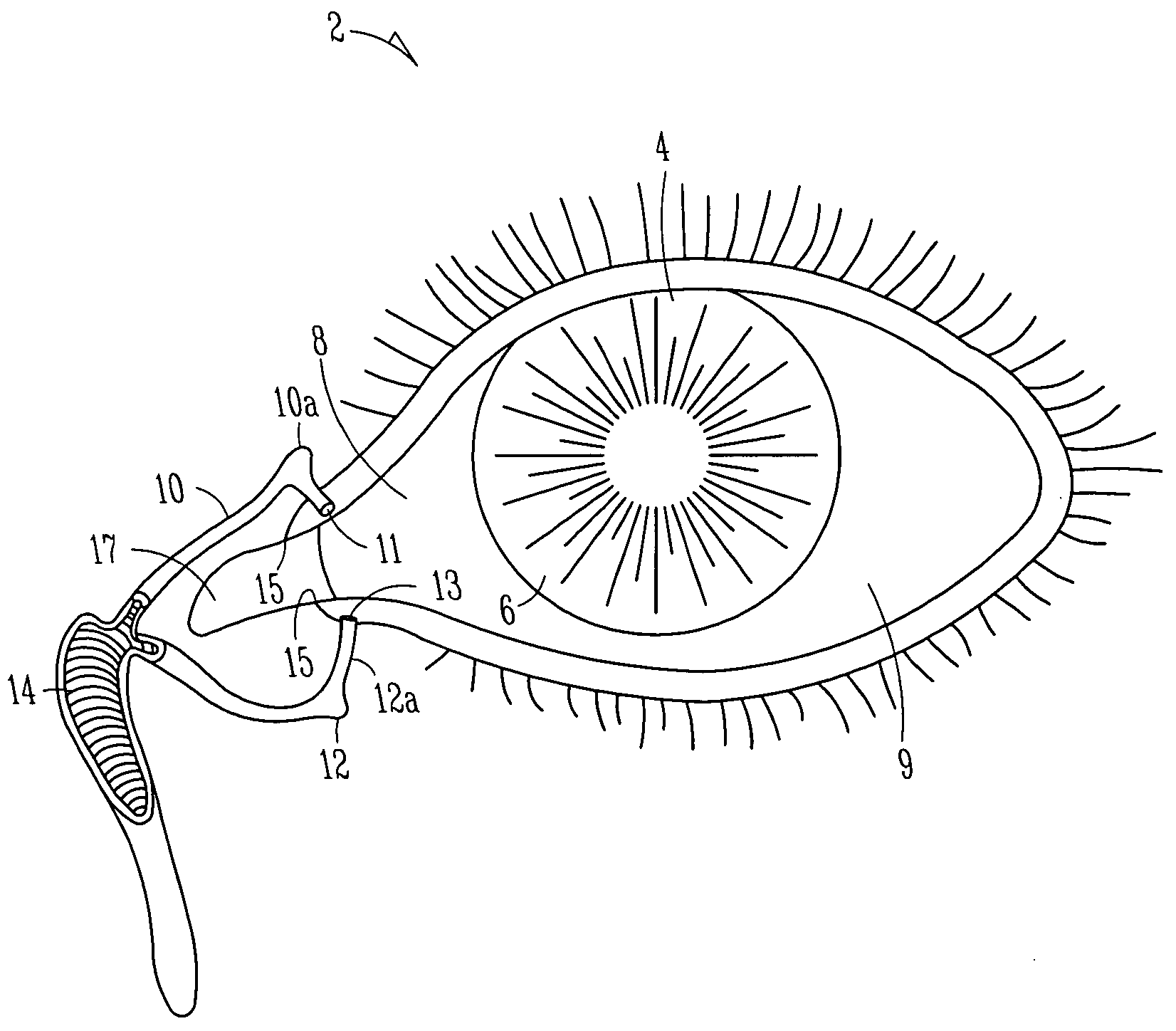 Lacrimal implant detection