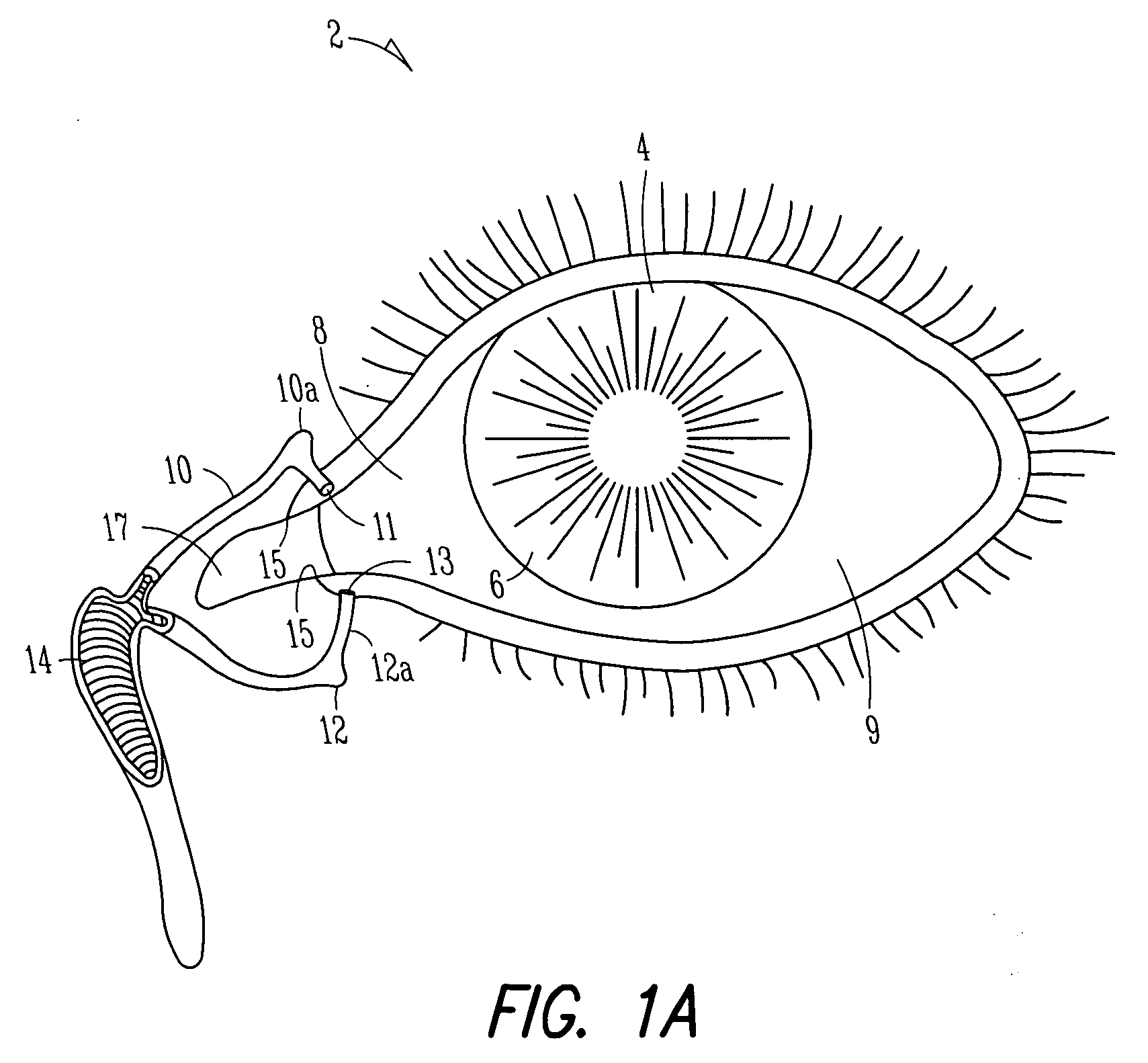 Lacrimal implant detection