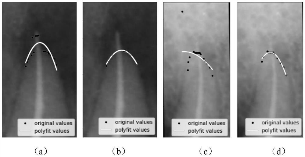 Method for segmenting tooth root image by using key point detection polynomial fitting curve