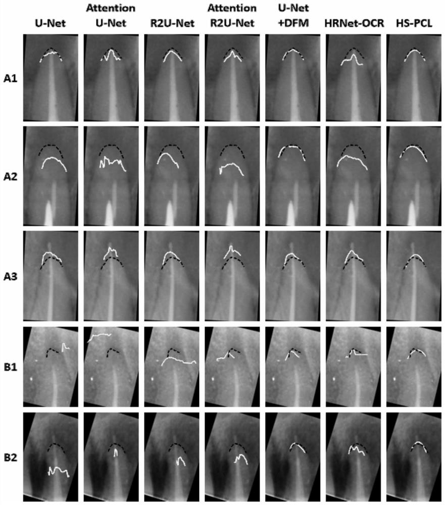 Method for segmenting tooth root image by using key point detection polynomial fitting curve