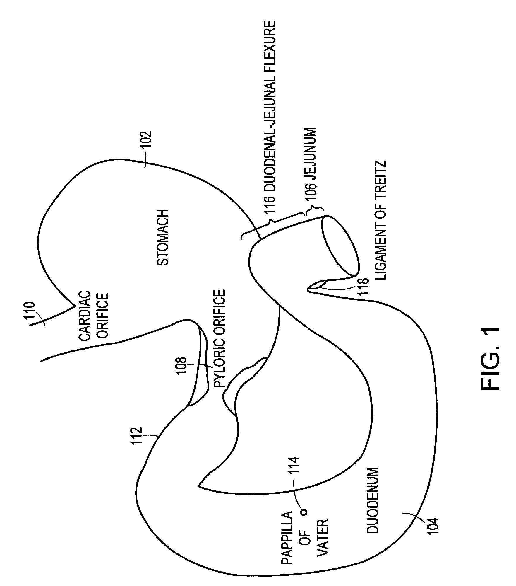 Anti-obesity devices