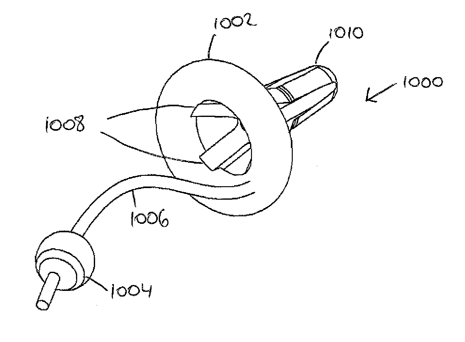 Adjustable tension ring for amelioration of urinary incontinence in females