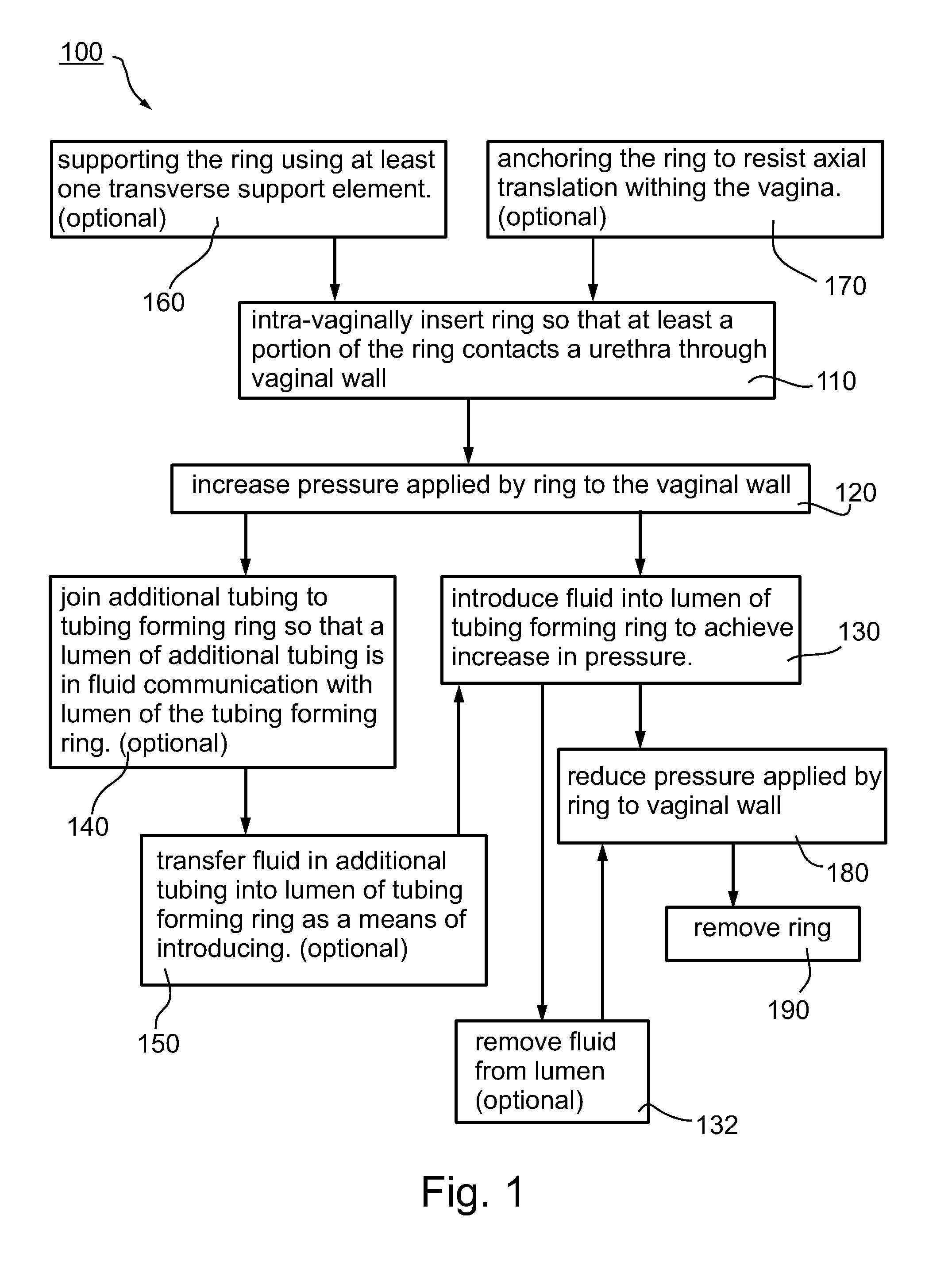 Adjustable tension ring for amelioration of urinary incontinence in females