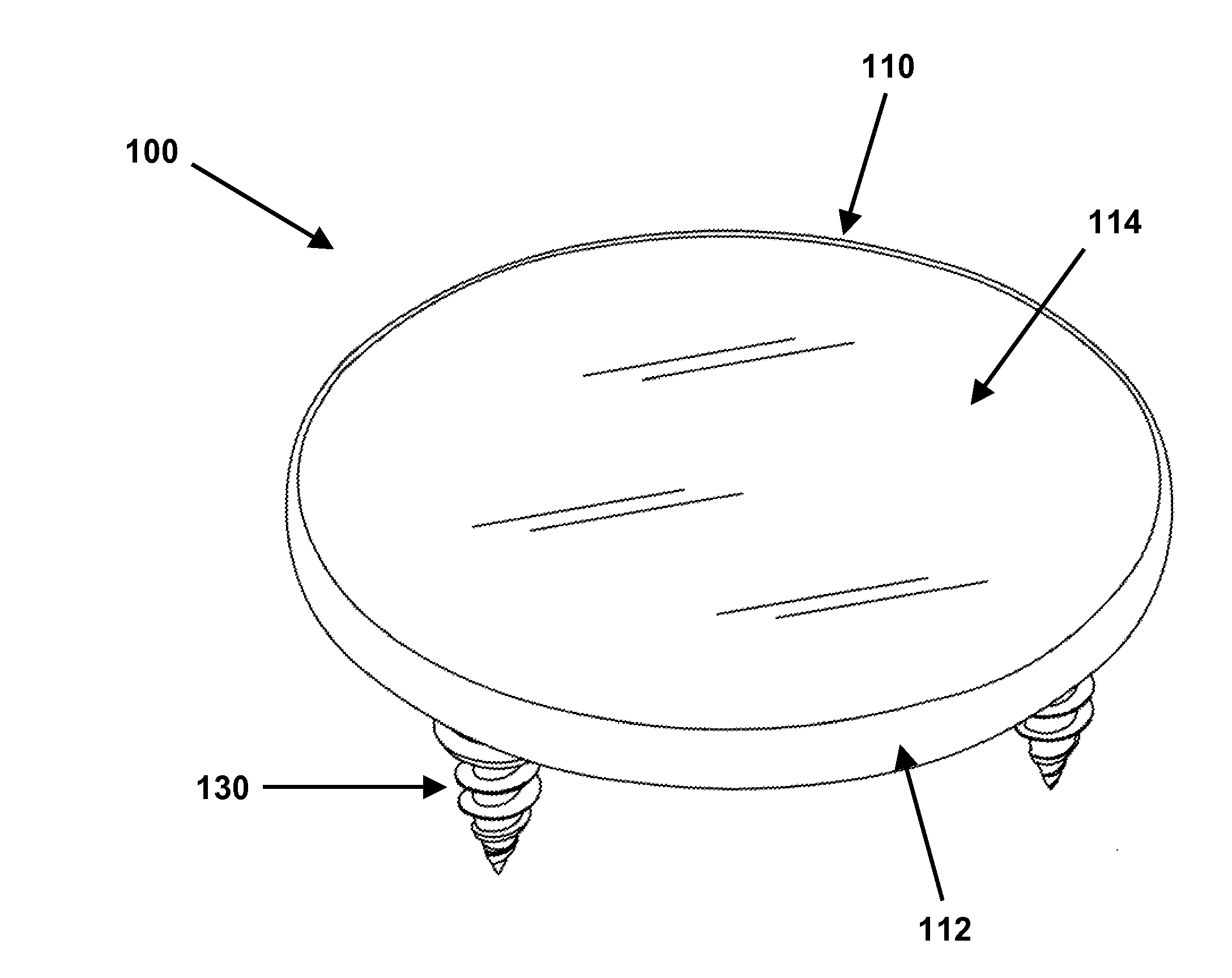 Rim anchoring systems for flexible surgical implants for replacing cartilage