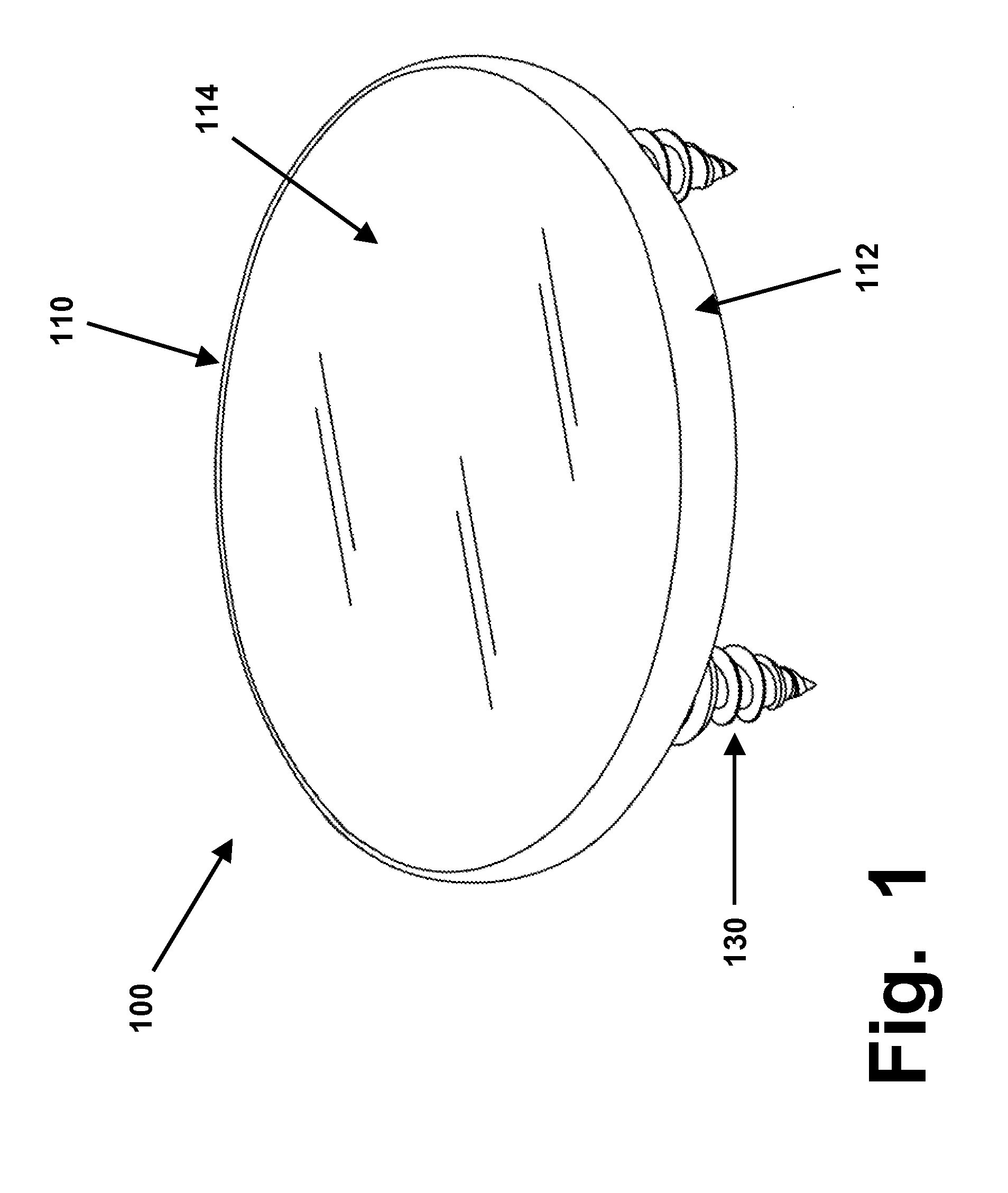 Rim anchoring systems for flexible surgical implants for replacing cartilage