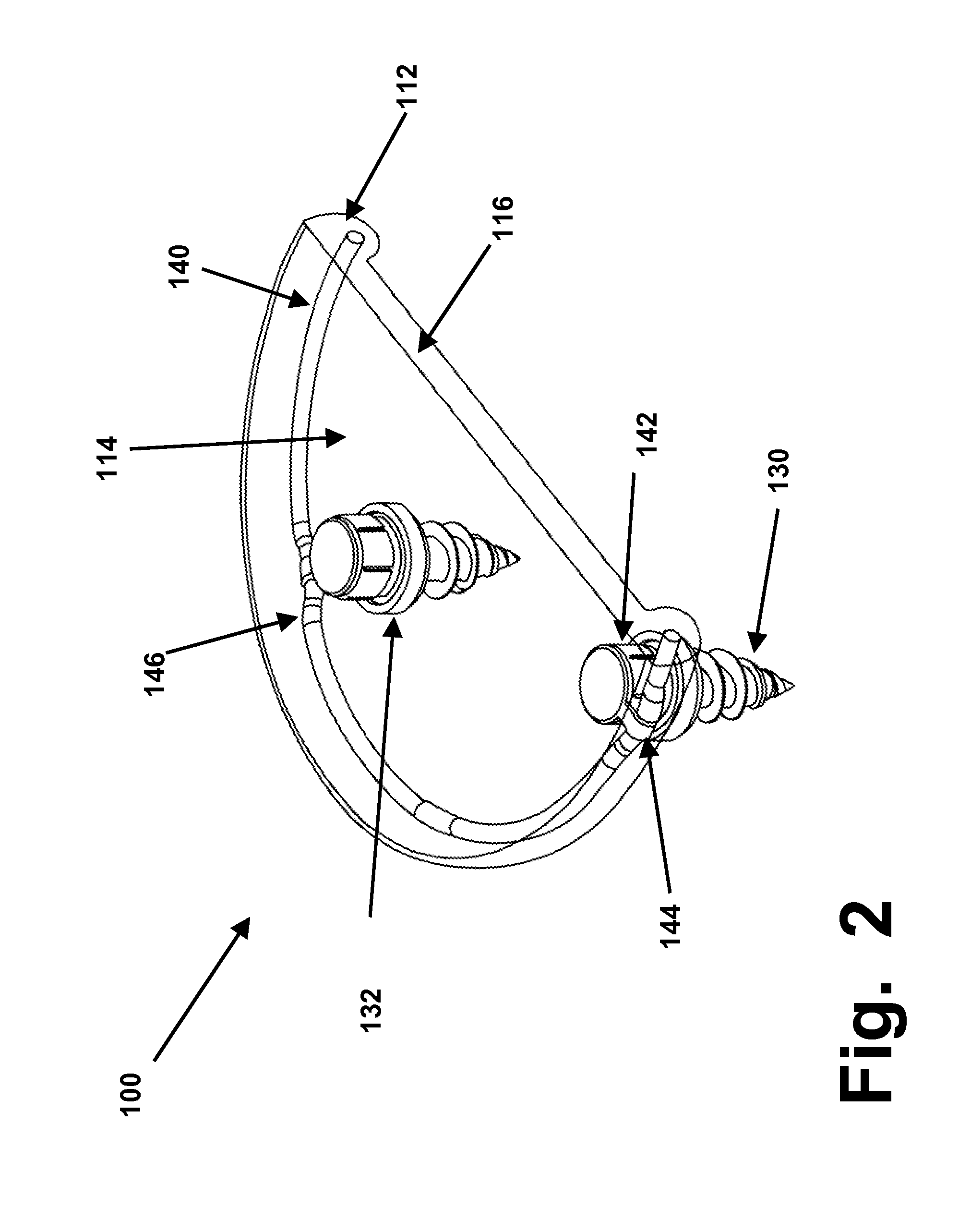 Rim anchoring systems for flexible surgical implants for replacing cartilage