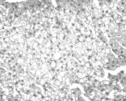 Chinese medicinal composition for preventing and treating hyperlipaemia and fatty liver and preparation method thereof