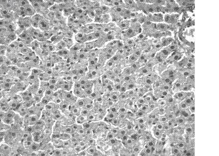 Chinese medicinal composition for preventing and treating hyperlipaemia and fatty liver and preparation method thereof