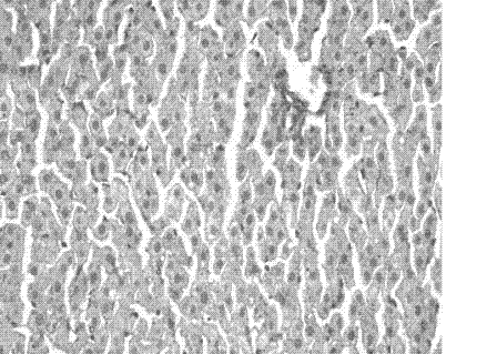 Chinese medicinal composition for preventing and treating hyperlipaemia and fatty liver and preparation method thereof