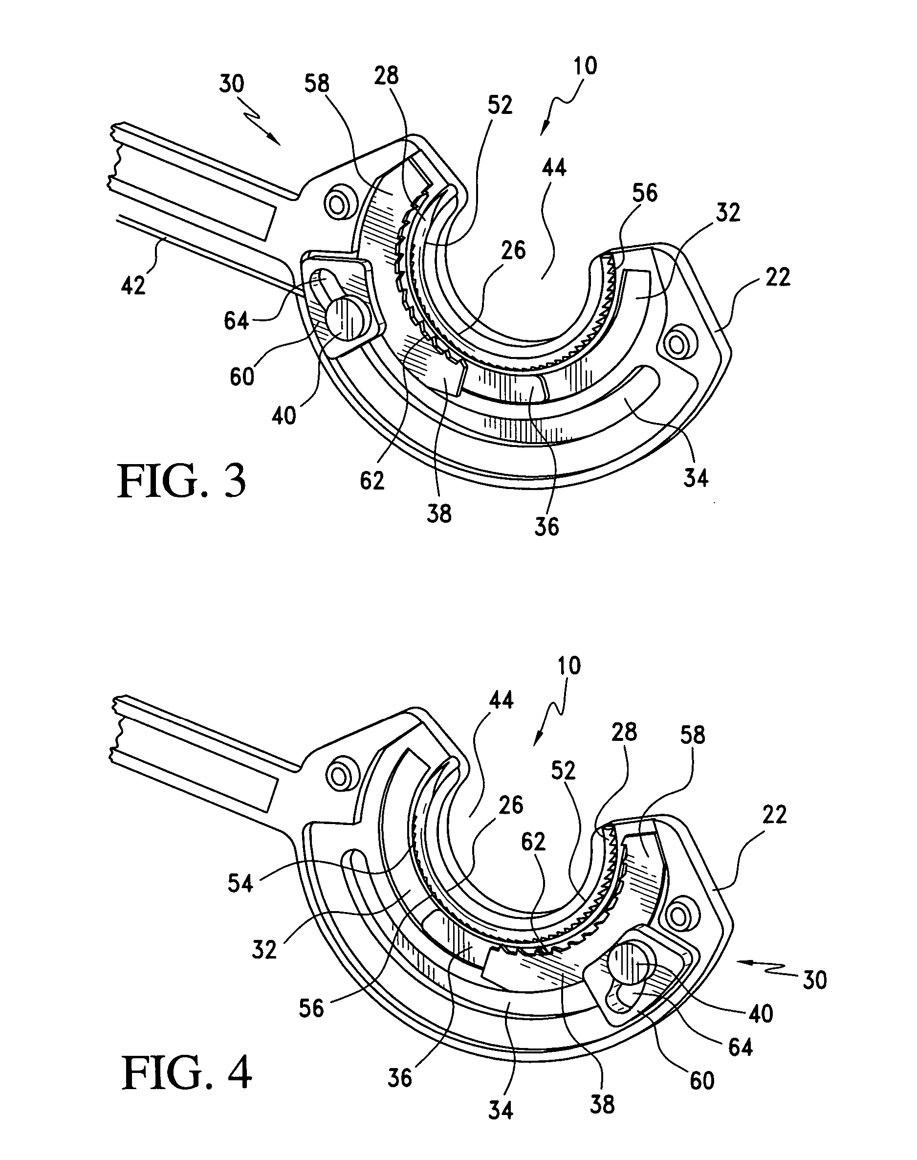 Endoscopic suturing device