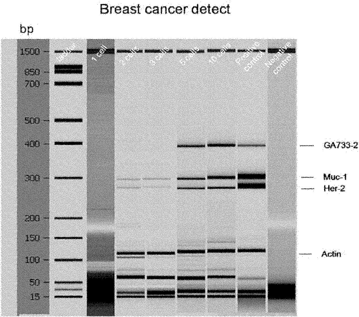 Kit for detecting free breast cancer cell marker in blood