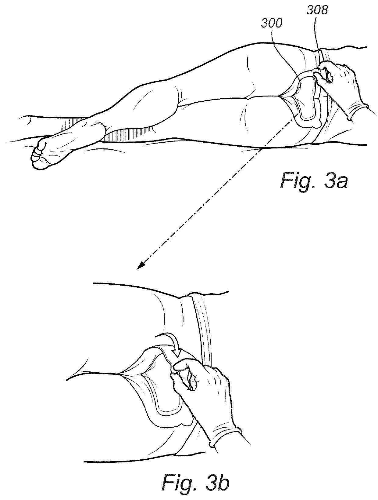 Medical dressing