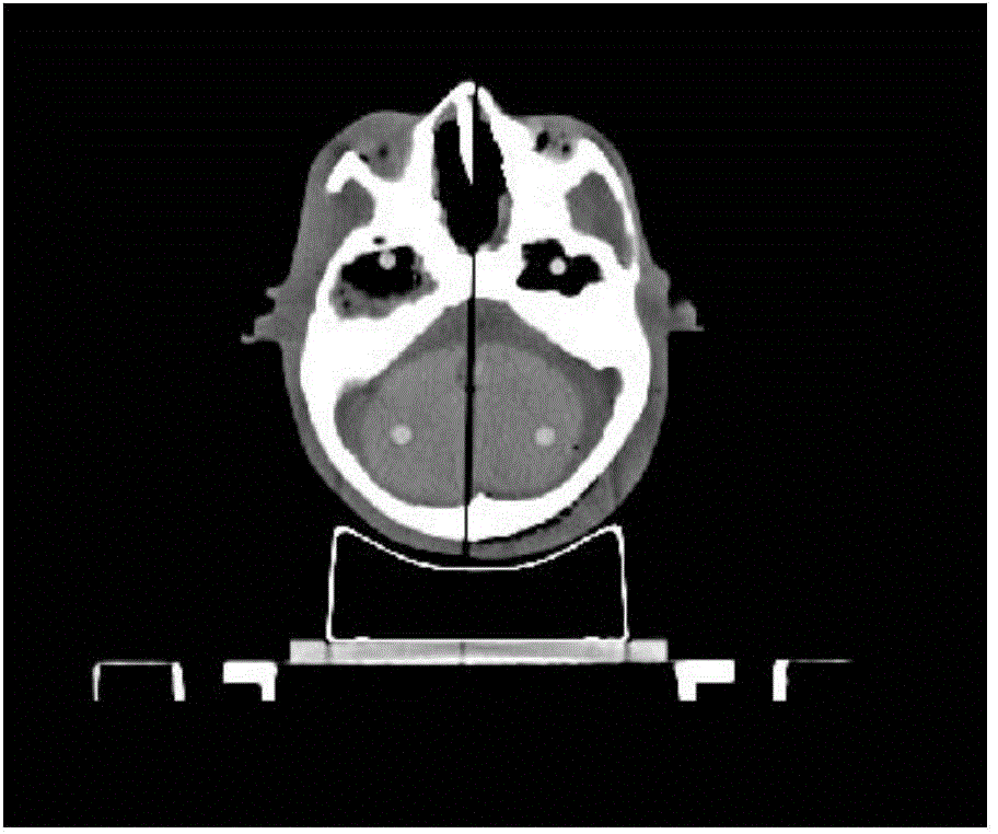 Verification method for ensuring accurate operation of intensity modulated radiation therapy