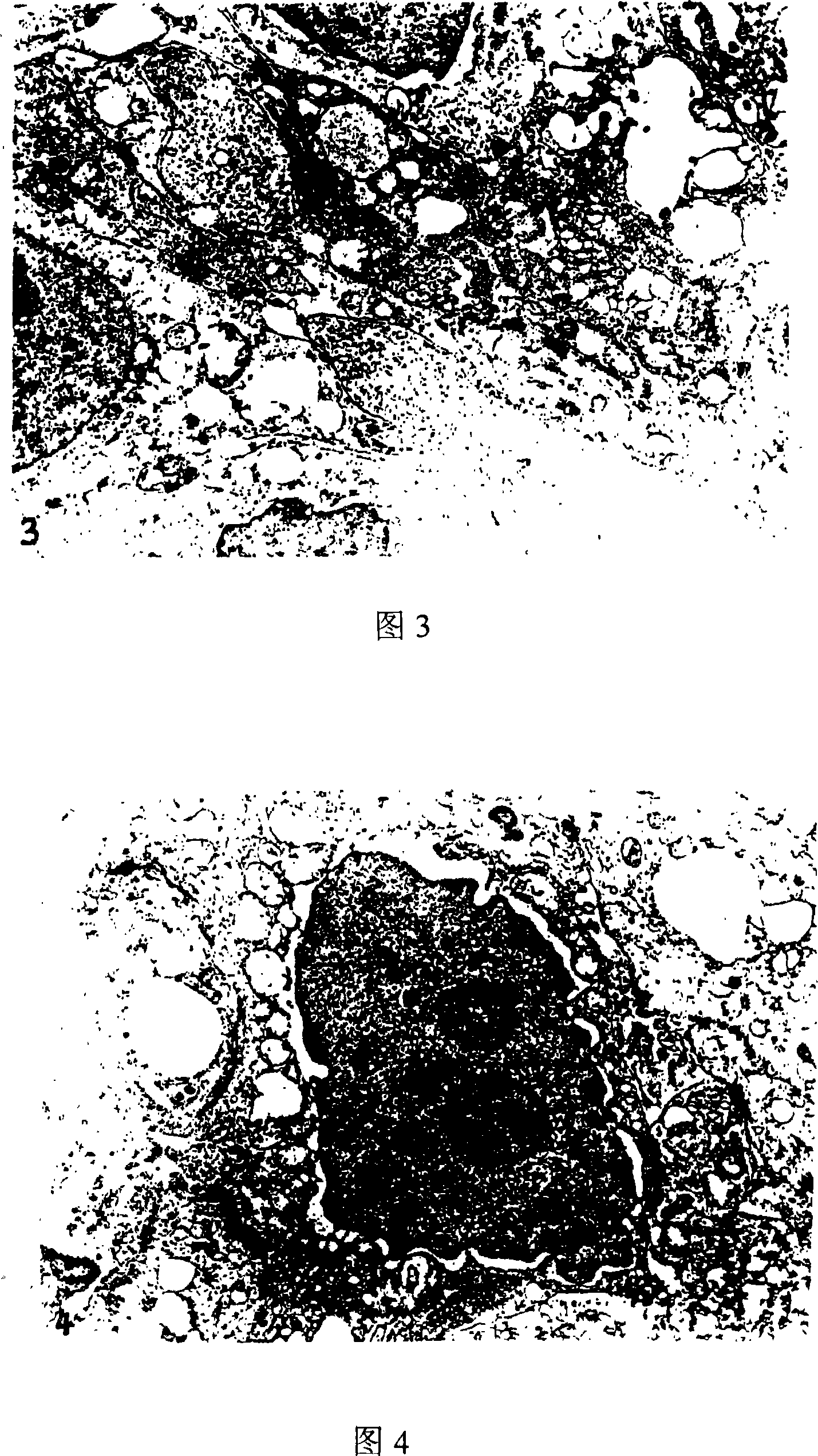 Pharmaceutical composition, preparing method and use the same