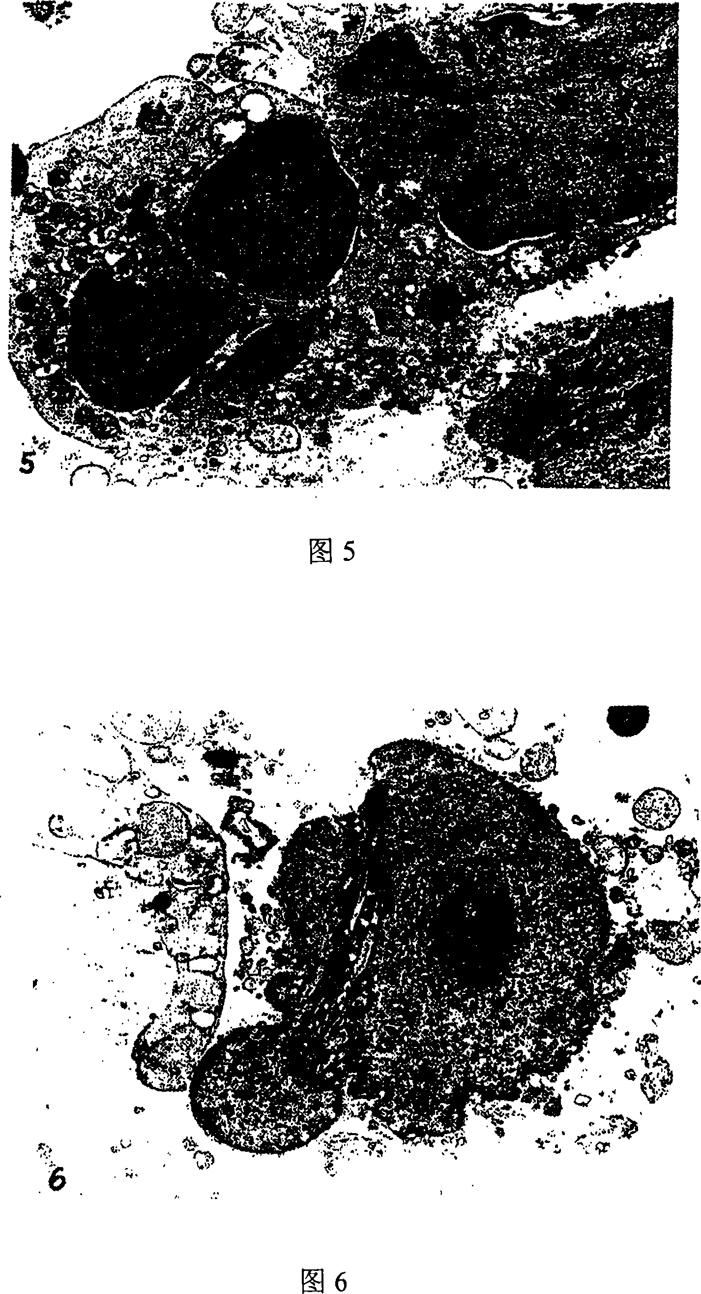 Pharmaceutical composition, preparing method and use the same