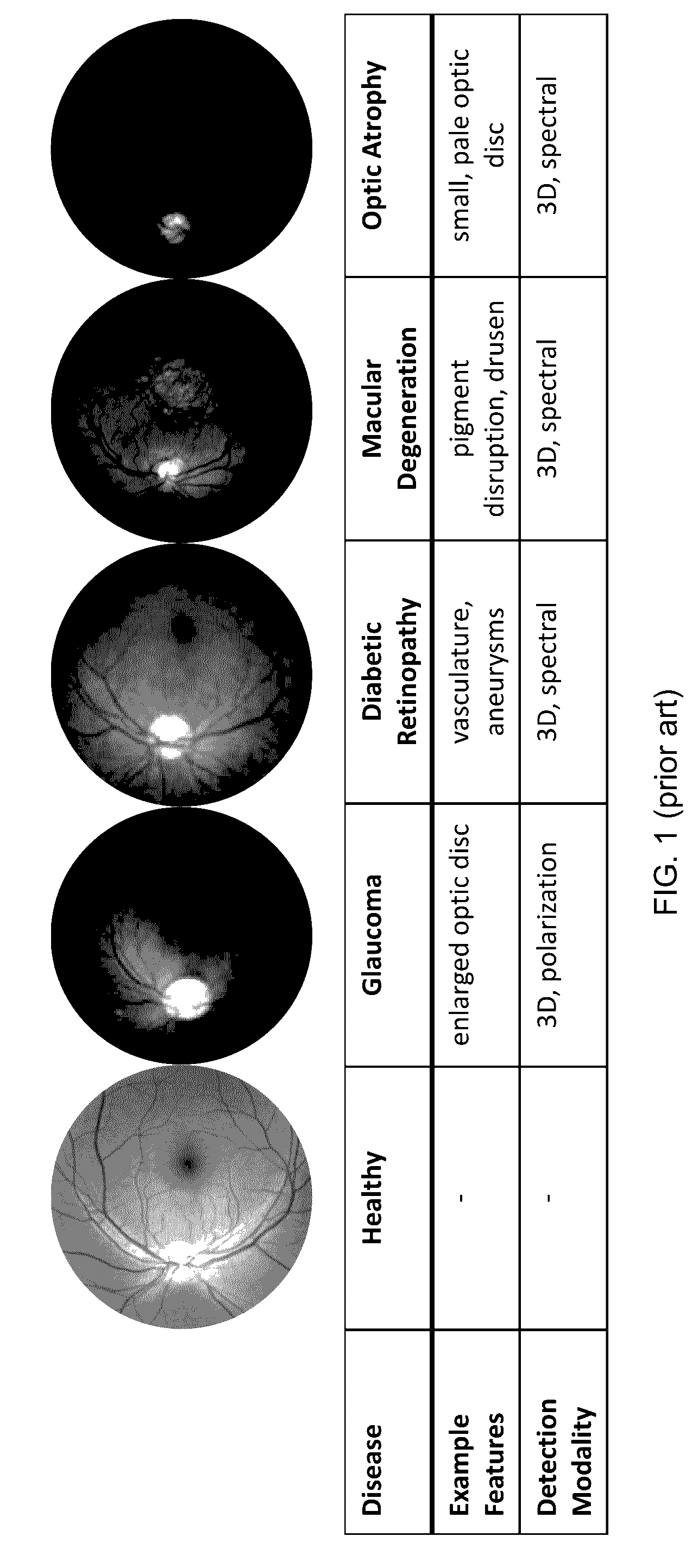 Simultaneous Capture of Filtered Images of the Eye