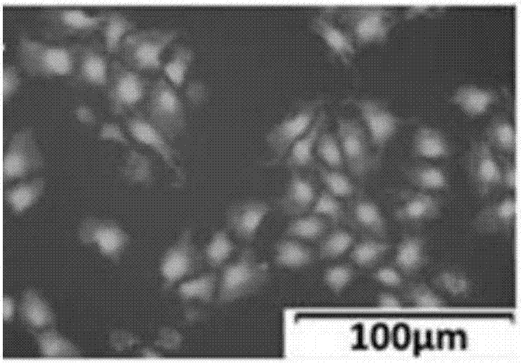 Biological gel for treating refractory skin damage and application of biological gel