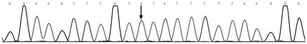 Mutant hereditary arrhythmia gene and application thereof