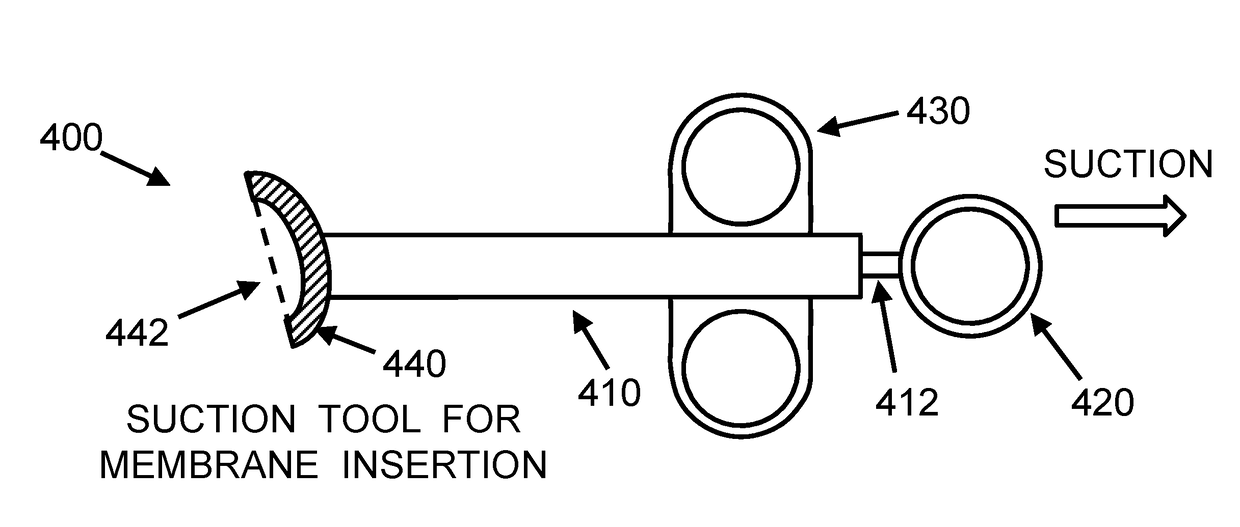 Surgical tools and kits for cartilage repair using  placental, amniotic, or similar membranes