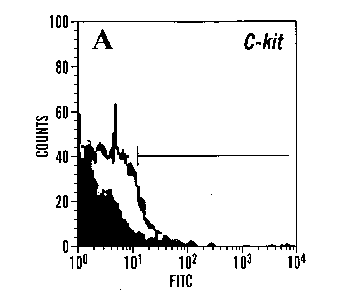 Methods of isolation, expansion and differentiation of fetal stem cells from chorionic villus, amniotic fluid, and placenta and therapeutic uses thereof