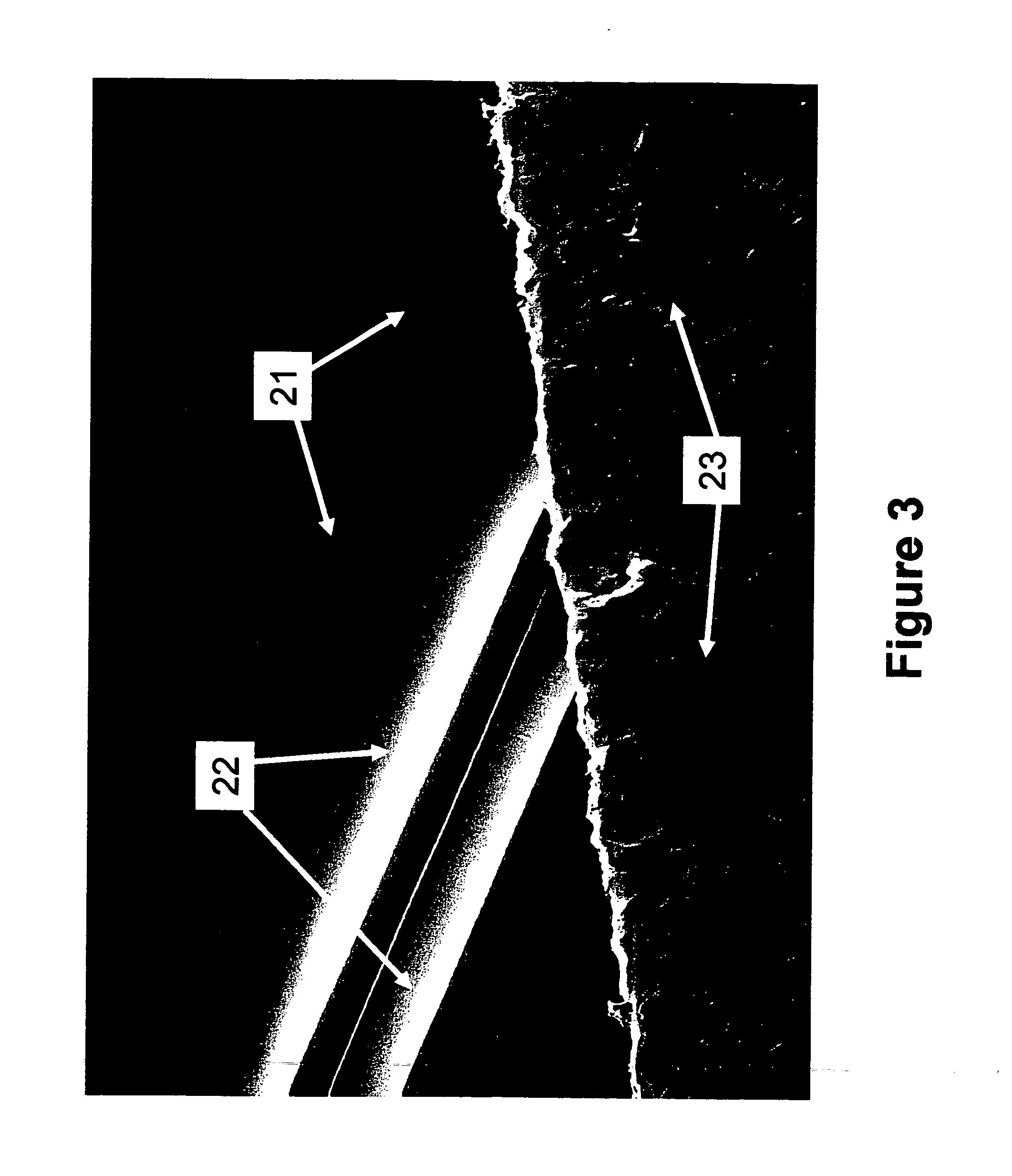 Microdialysis needle assembly