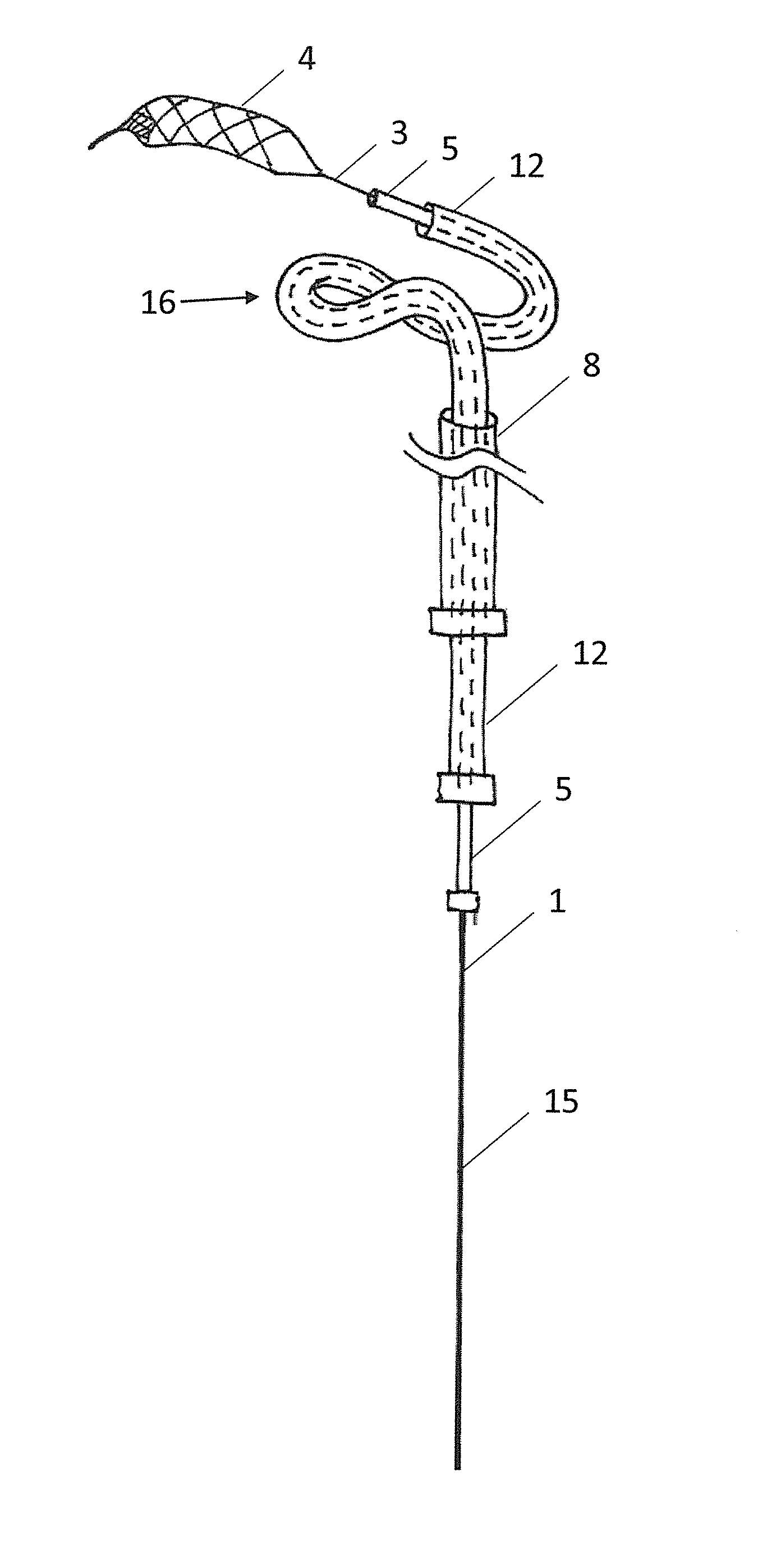 Clot retrieval system for removing occlusive clot from a blood vessel