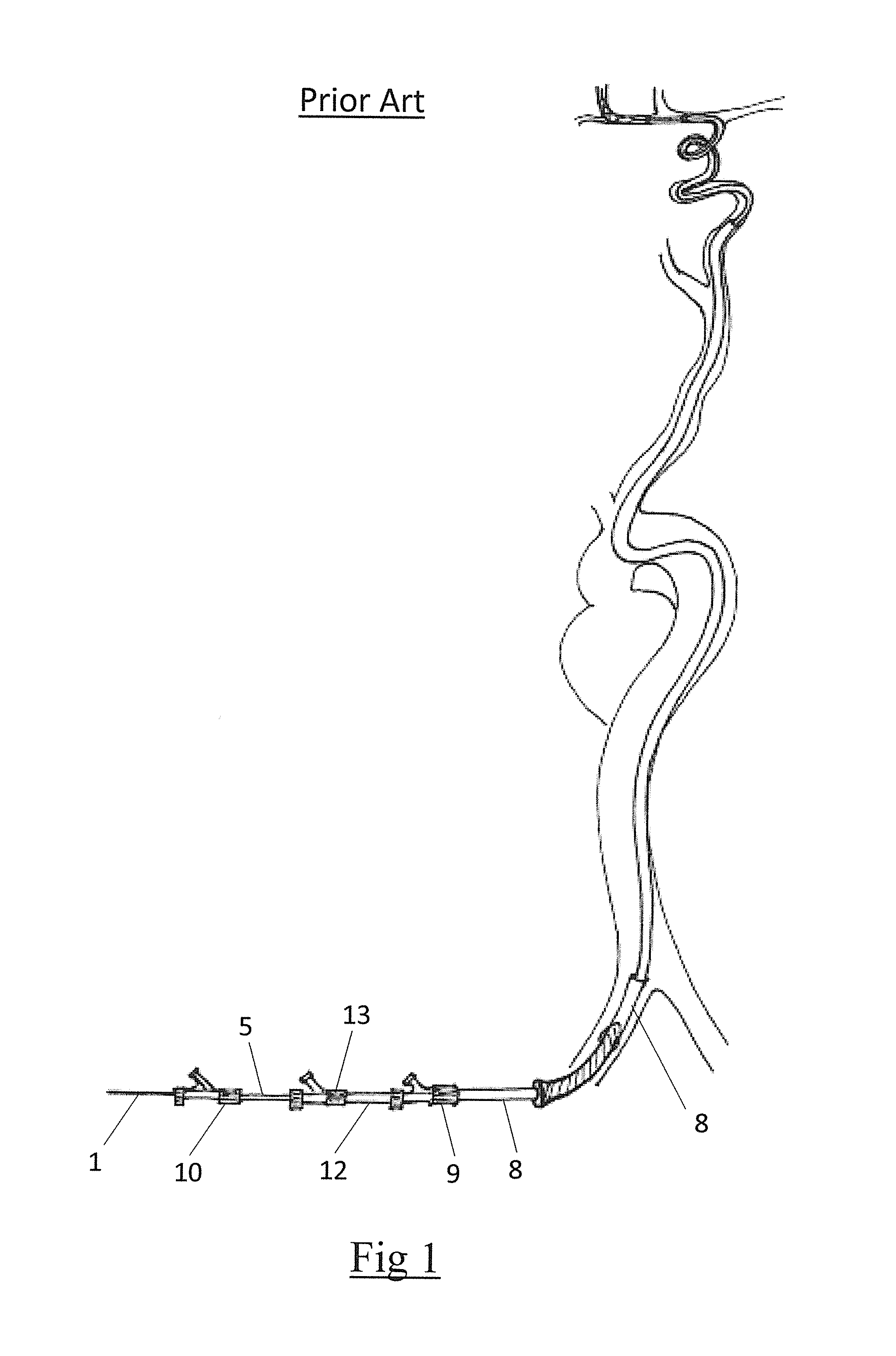 Clot retrieval system for removing occlusive clot from a blood vessel