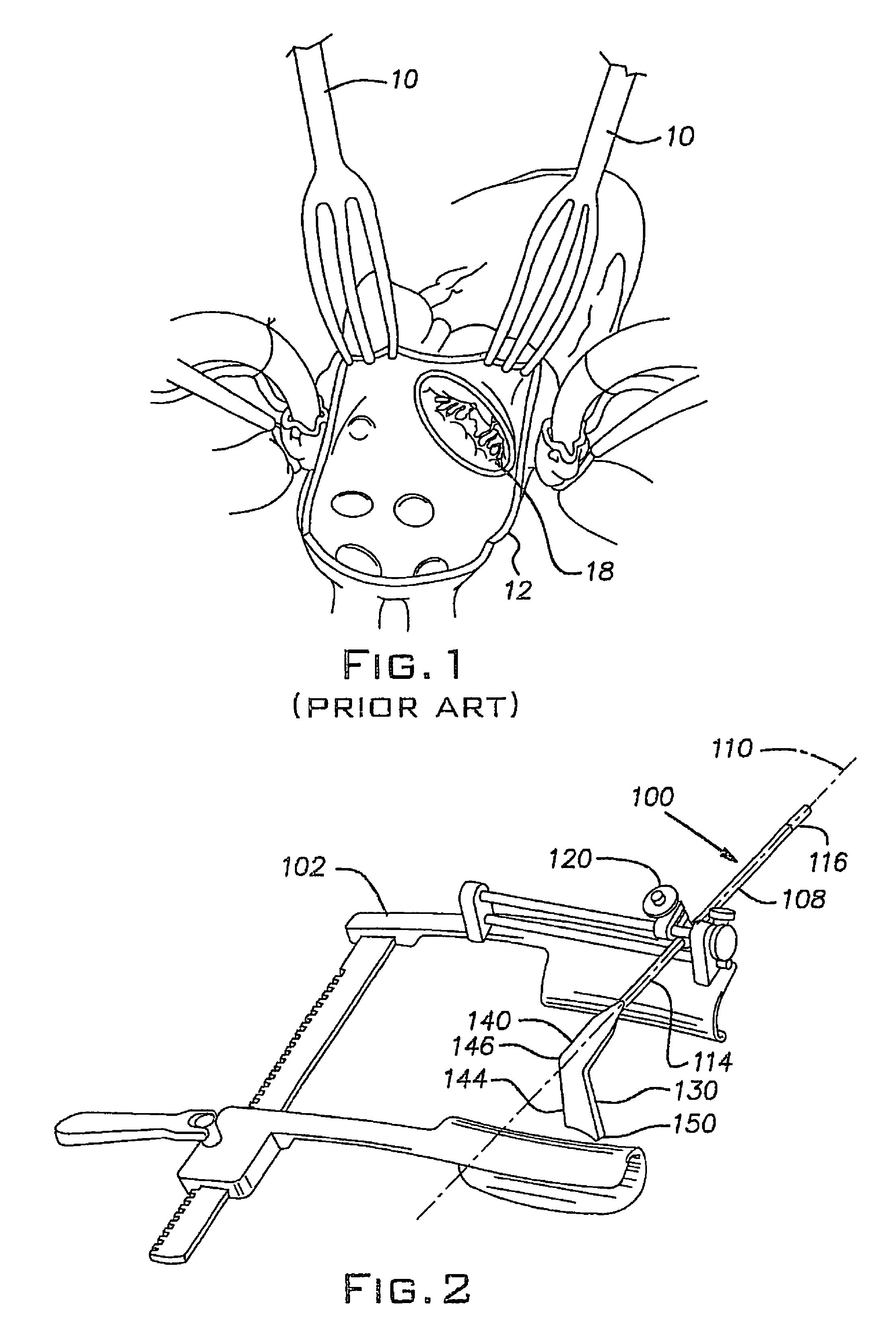 Surgical retractors and method of operation