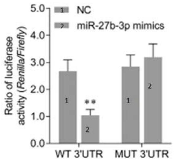 Application of hsa_circ_0006470 as target in preparation of miR-27b-3p regulator