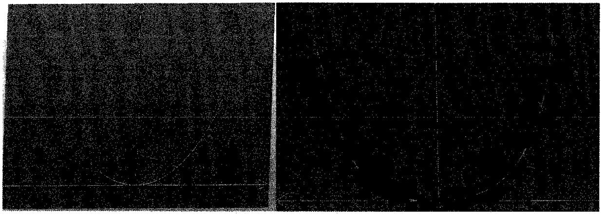 A Digital Alignment Method Based on Tooth Root Information