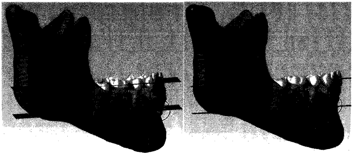 A Digital Alignment Method Based on Tooth Root Information