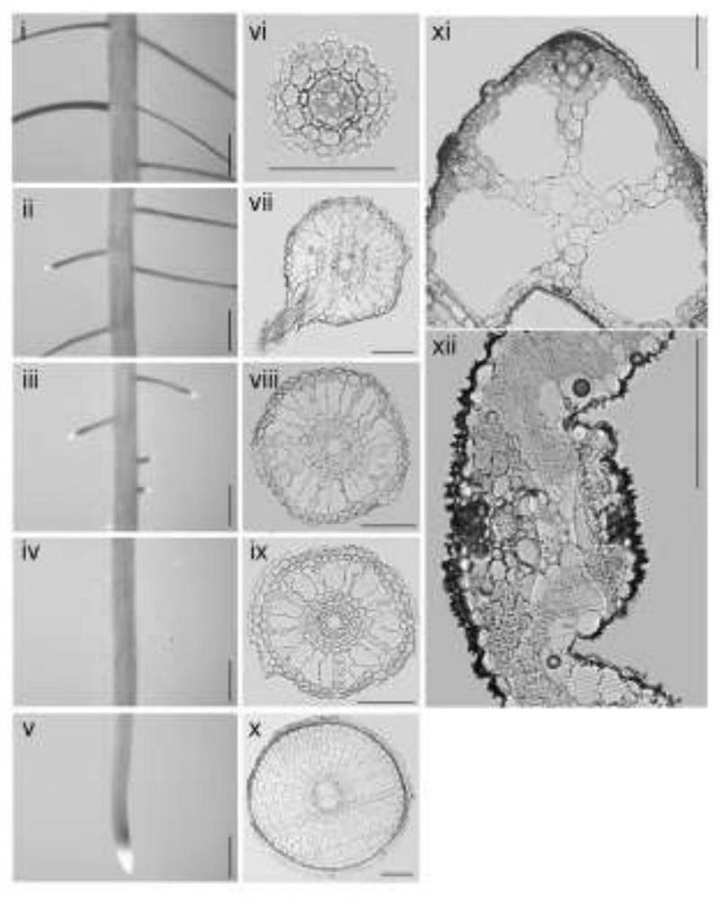 Applications of two WRKY transcription factor genes in rice and encoded proteins thereof