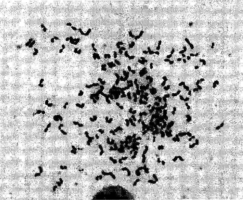 Mold toxin penicillic acid monoclone antibody and preparation method thereof