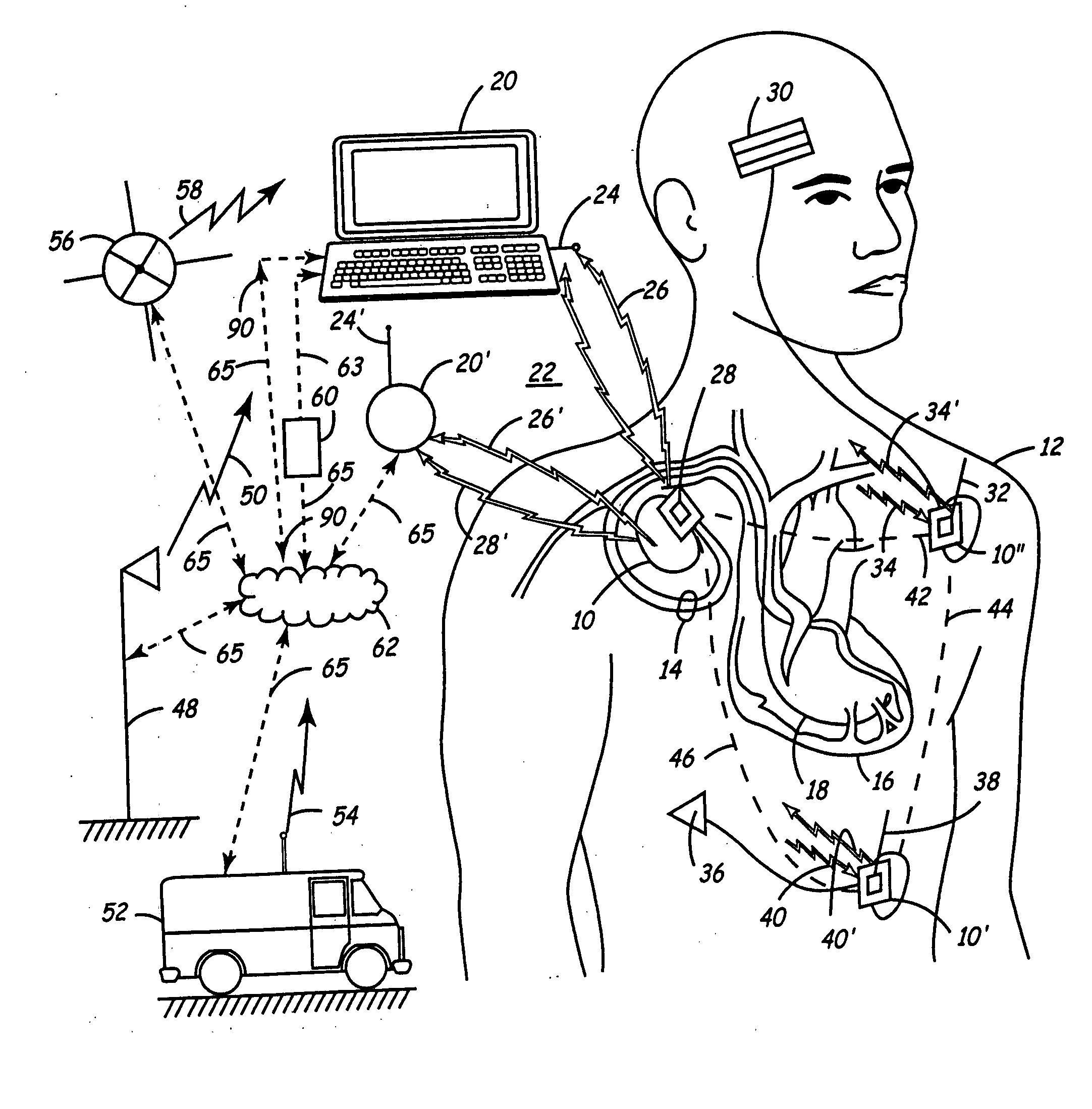 Virtual remote monitor, alert, diagnostics and programming for implantable medical device systems