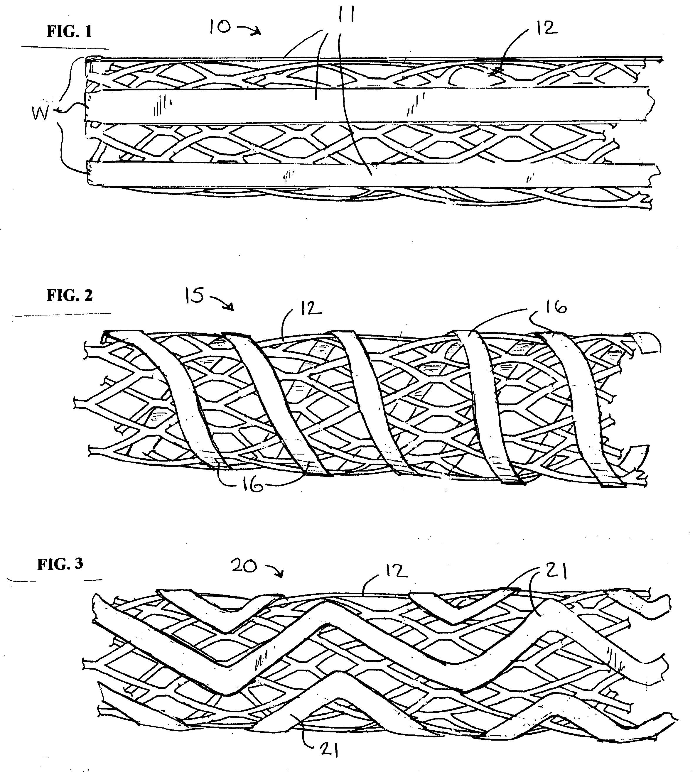 Stent with auxiliary treatment structure