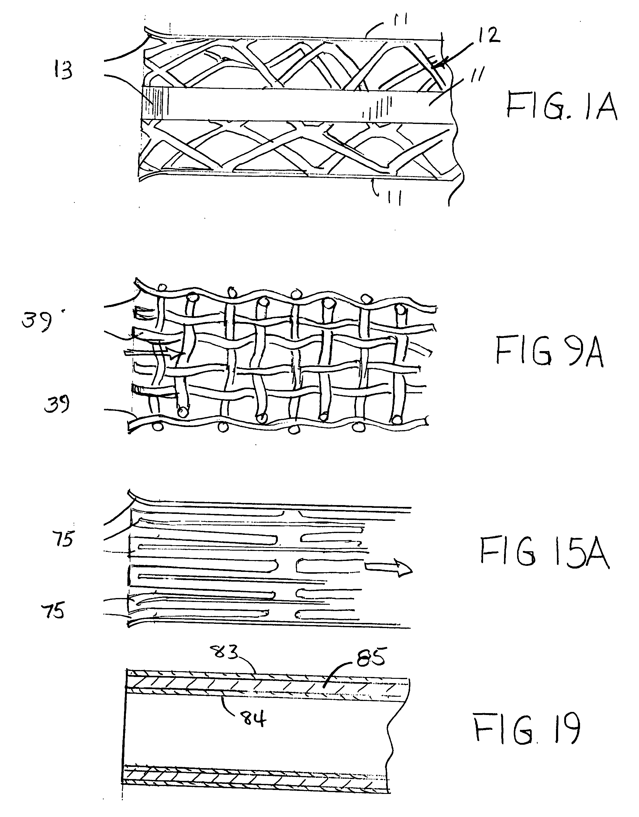 Stent with auxiliary treatment structure