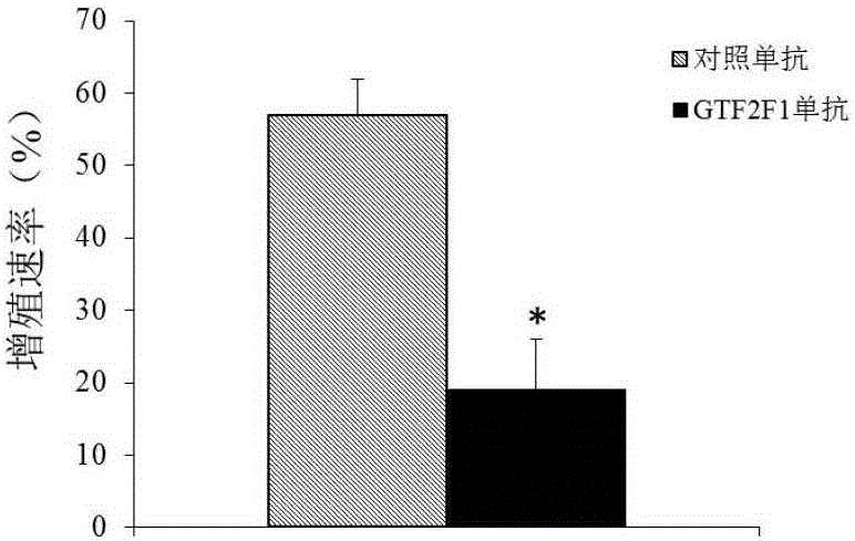 Diagnosis and treatment product for multiple myeloma biomarker